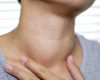 What causes the psychological symptoms with thyroid?